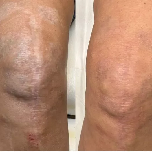 Product image - Restorative Camouflage