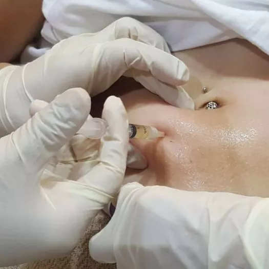 Product image - Localized Fat Reduction Consultation