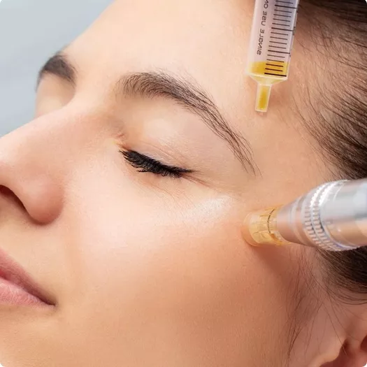 Product image - PRP Therapy