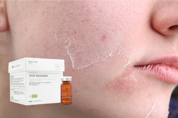 Peel Skin Recovery là gì? Cách sử dụng Peel Skin Recovery hiệu quả nhất