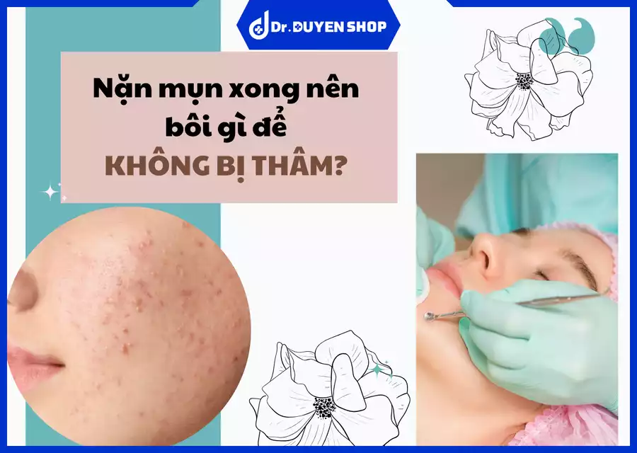 Nặn Mụn Xong Nên Bôi Gì Để Ngừa Thâm? Cách Chăm Sóc Da Sau Khi Nặn Mụn