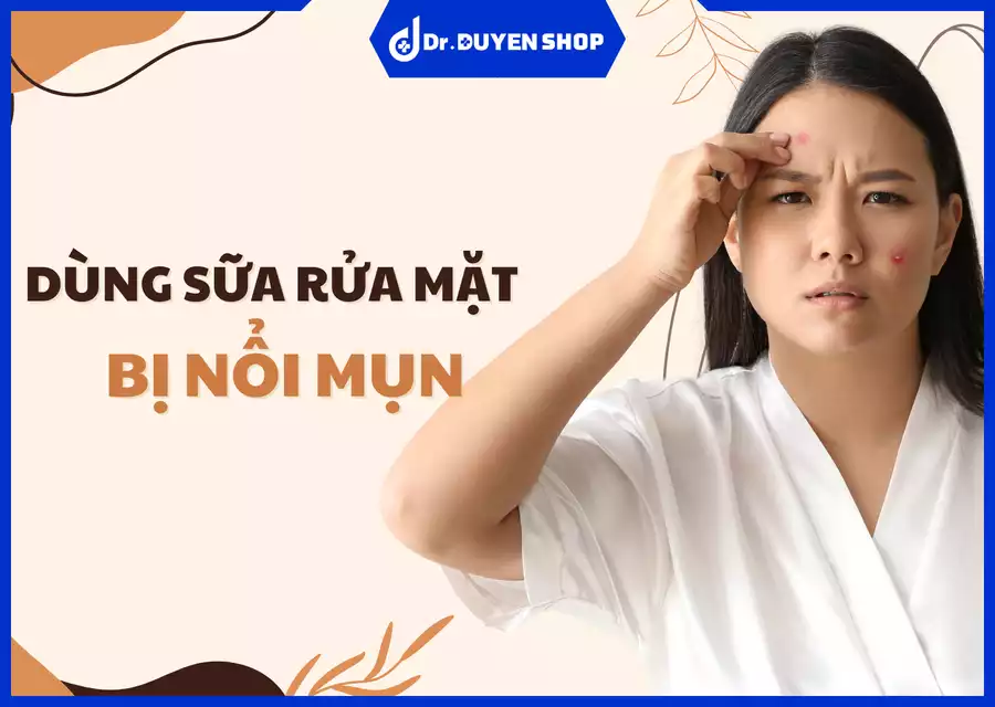 Dùng sữa rửa mặt bị nổi mụn: Nguyên nhân và cách khắc phục hiệu quả