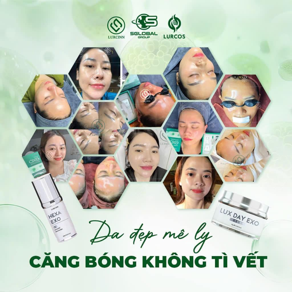 Lux Day Exo Cream Lurcinn Kem Dưỡng Săn Chắc Căng Bóng Trắng Sáng 30g