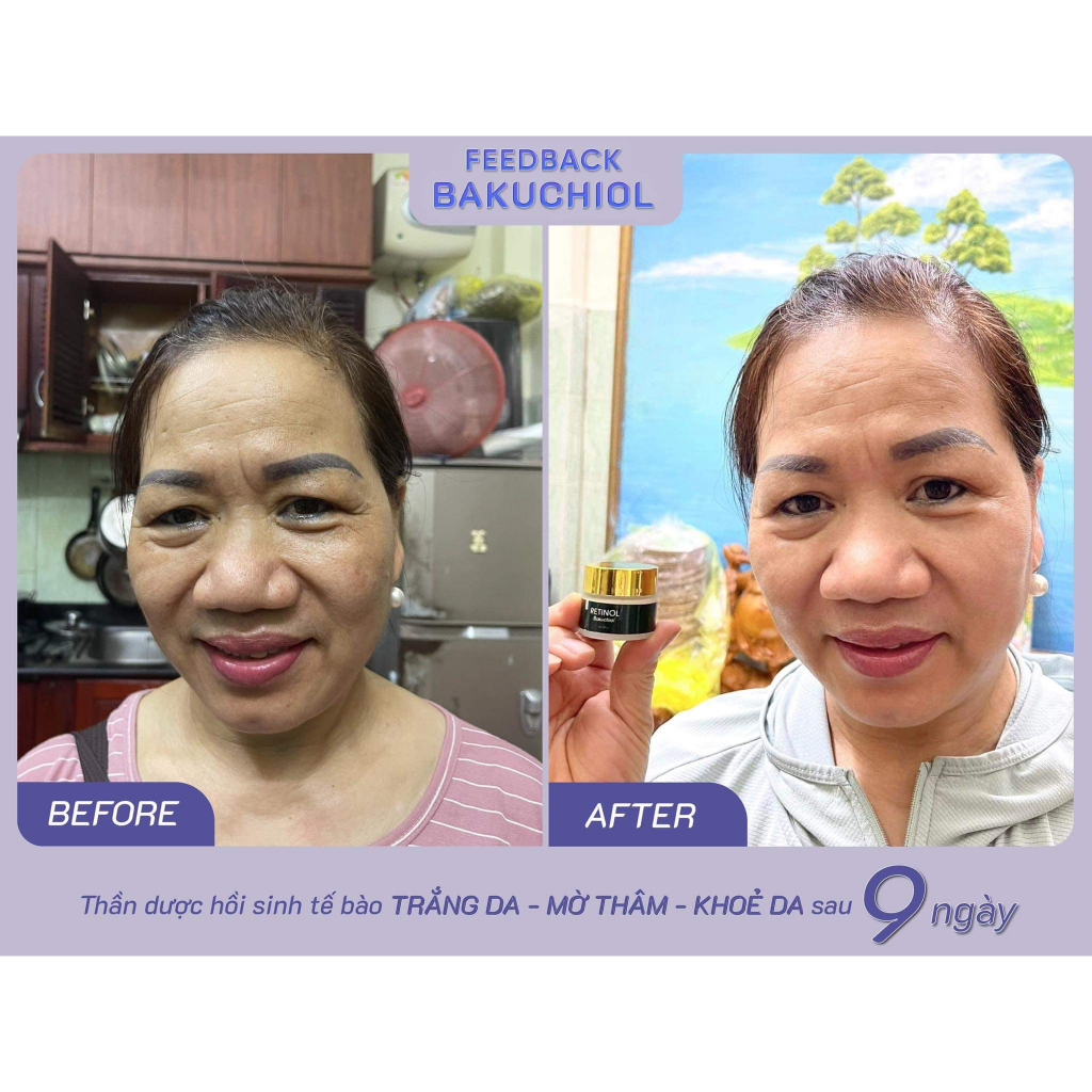 Tinh Chất Phục Hồi Da Lurcinn - Retinol Bakuchiol 15g_thumbnail_6