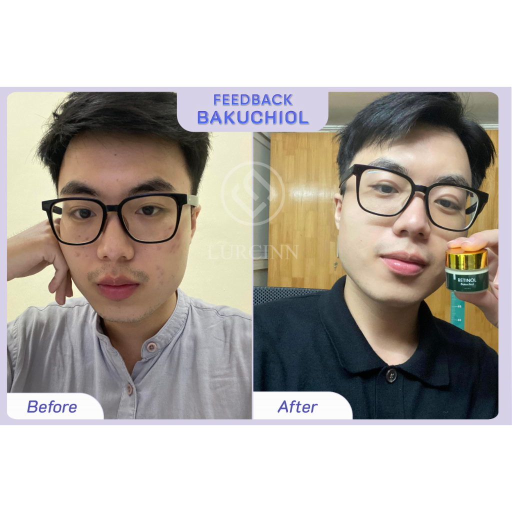 Tinh Chất Phục Hồi Da Lurcinn - Retinol Bakuchiol 15g_thumbnail_7