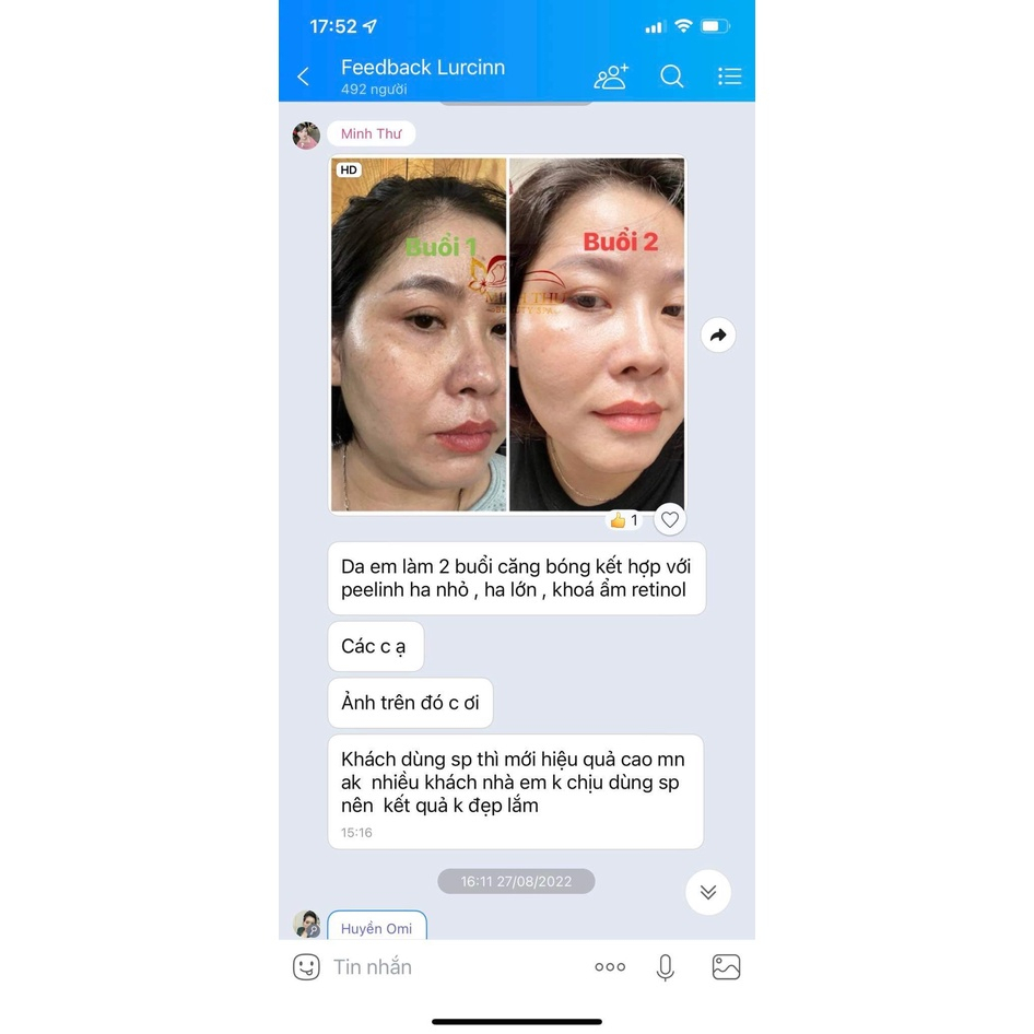 Tẩy Tế Bào Chết Lurcinn Bright No 1 Peeling Serum AHA, BHA Tăng Sinh Collagen Dưỡng Trắng Sáng Da 20ml_thumbnail_4