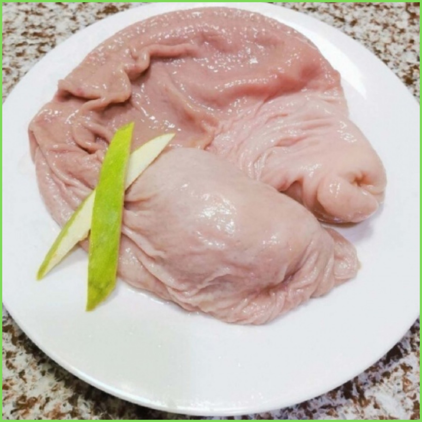 Dạ dày
