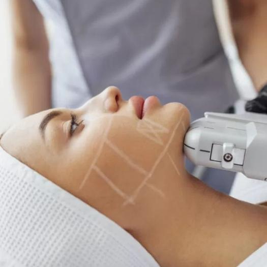 Product image - Sculpture du Visage (HIFU Face)