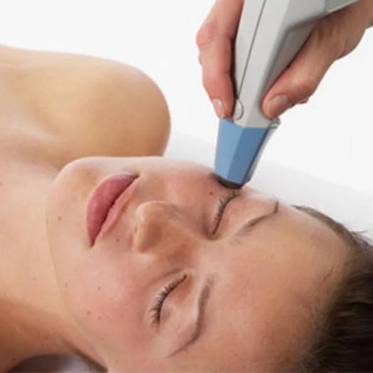 Product image - Contours du Visage (Exilis Face)