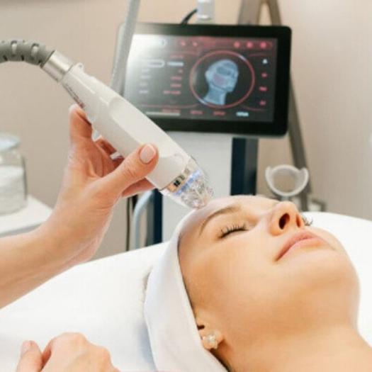 Product image - Renouveau Cutané (RF MN Skin Booster)