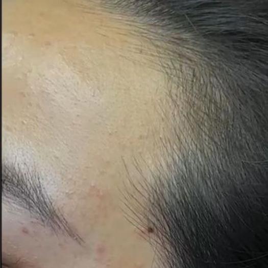 Product image - Hairline 3D Nano Restoration