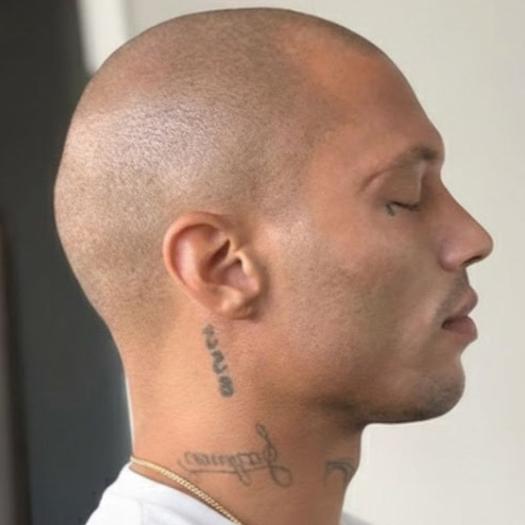 Product image - Scalp Micropigmentation