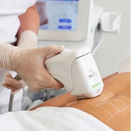 Product image - Sculpture du Corps (HIFU Body)