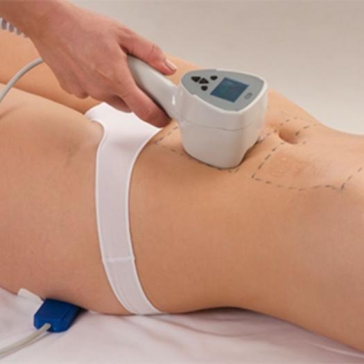 Product image - Sculpture du Corps (Exilis Body)