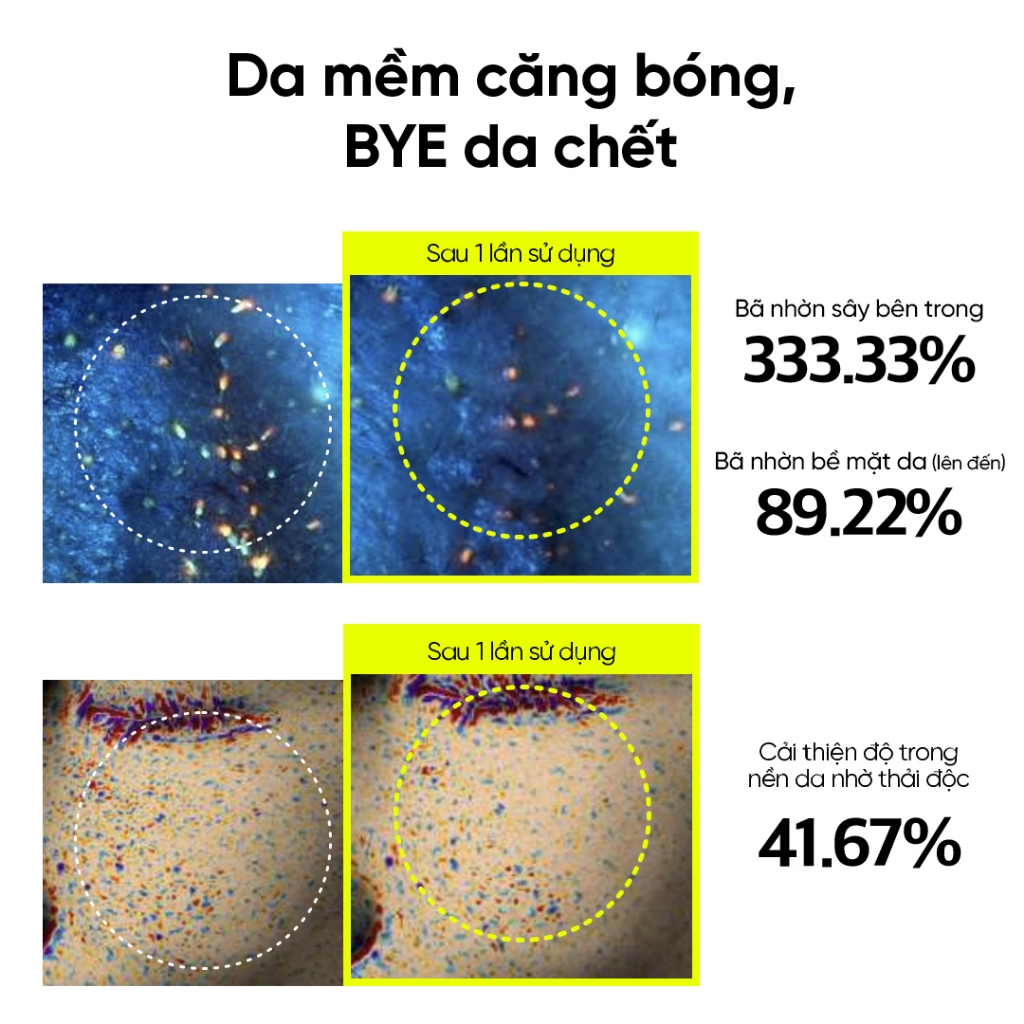 [BEPLAIN] Toner đậu xanh Beplain Mung Bean Pore Clearing LHA 265ml_thumbnail_3