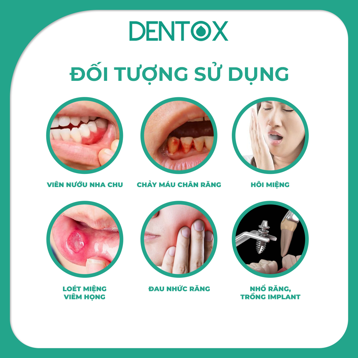 COMBO 2 CHAI Nước súc miệng Chuẩn Y khoa Dentox Khử hôi miệng Không cồn không cay 250ml_thumbnail_6