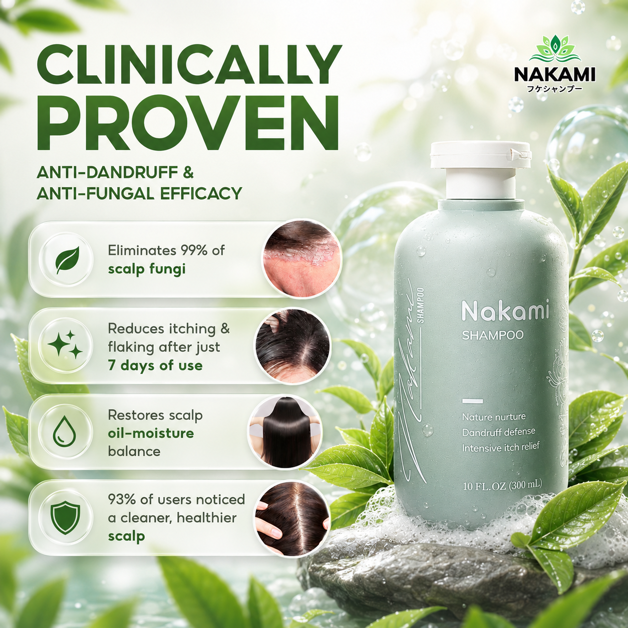 Nakami Anti-Dandruff Shampoo, Dandruff Remover, Anti-Fungal, Anti Itchy No.1 Japan 300mL