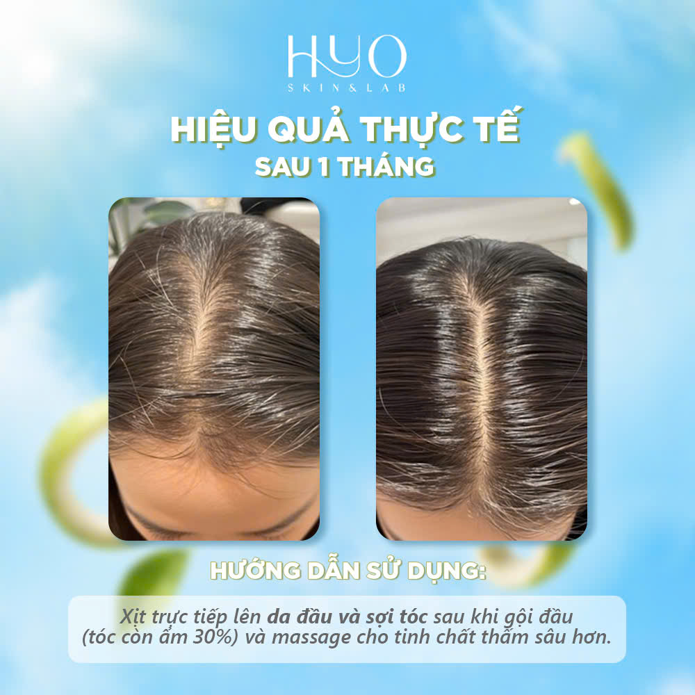 [A215] HAIIR TONIC 120ML - HYO SKIN & LAB_thumbnail_3