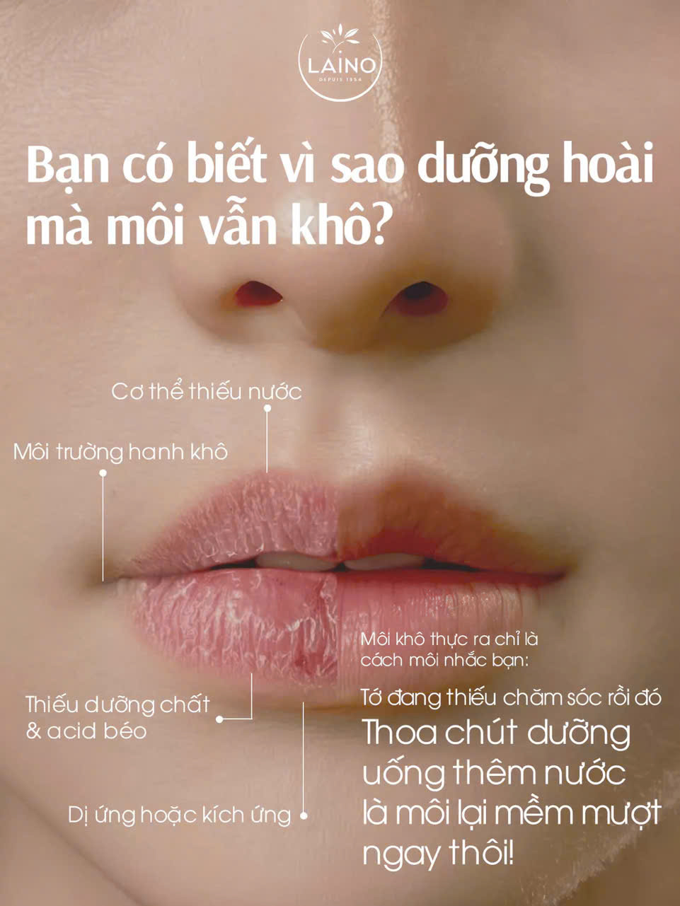 Son Dưỡng LAINO_thumbnail_10