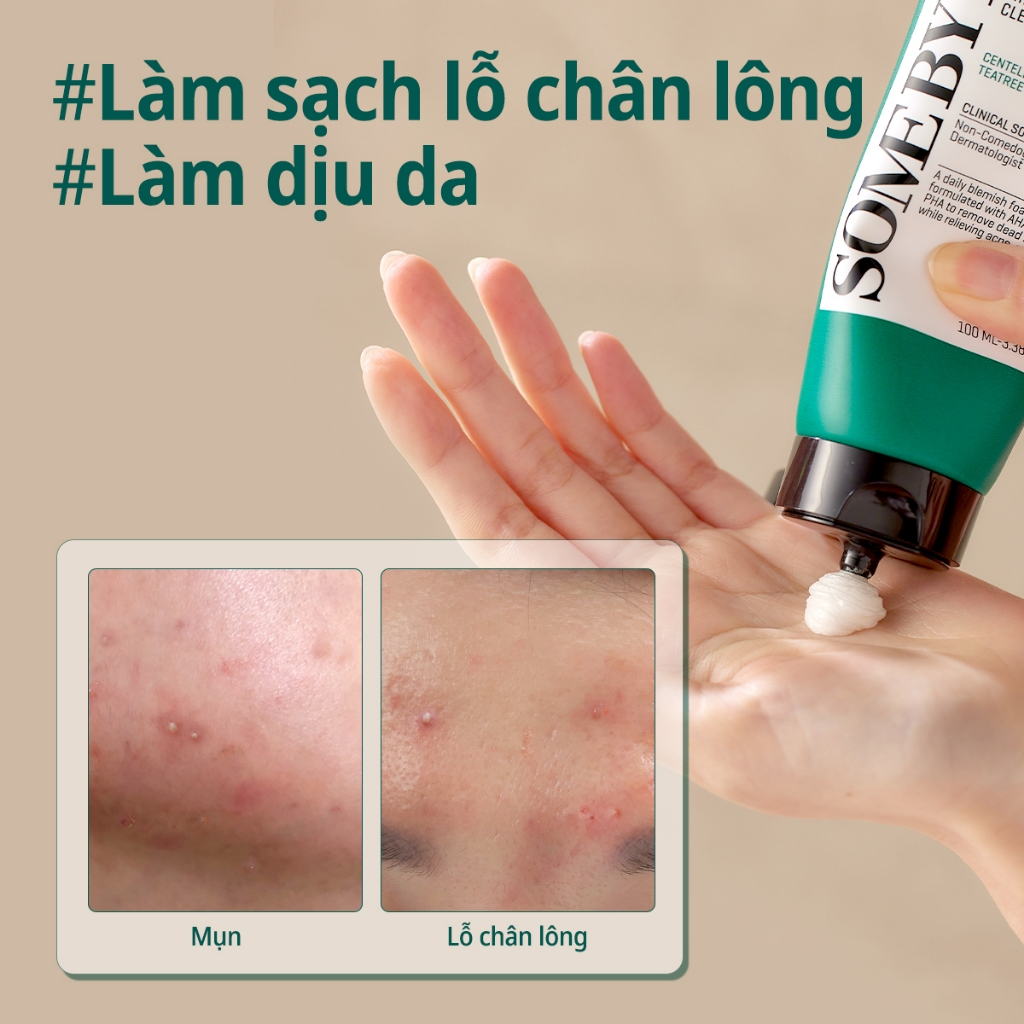 [SOME BY MI] Sữa rửa mặt cho da dầu mụn Some By Mi AHA-BHA-PHA 30 Days Miracle 100ml_thumbnail_2