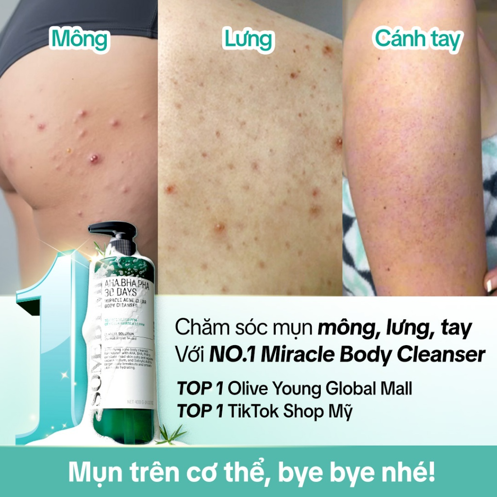 [SOME BY MI] Sữa tắm giảm mụn lưng Some By Mi AHA-BHA-PHA 30 Days Miracle 400g_thumbnail_4