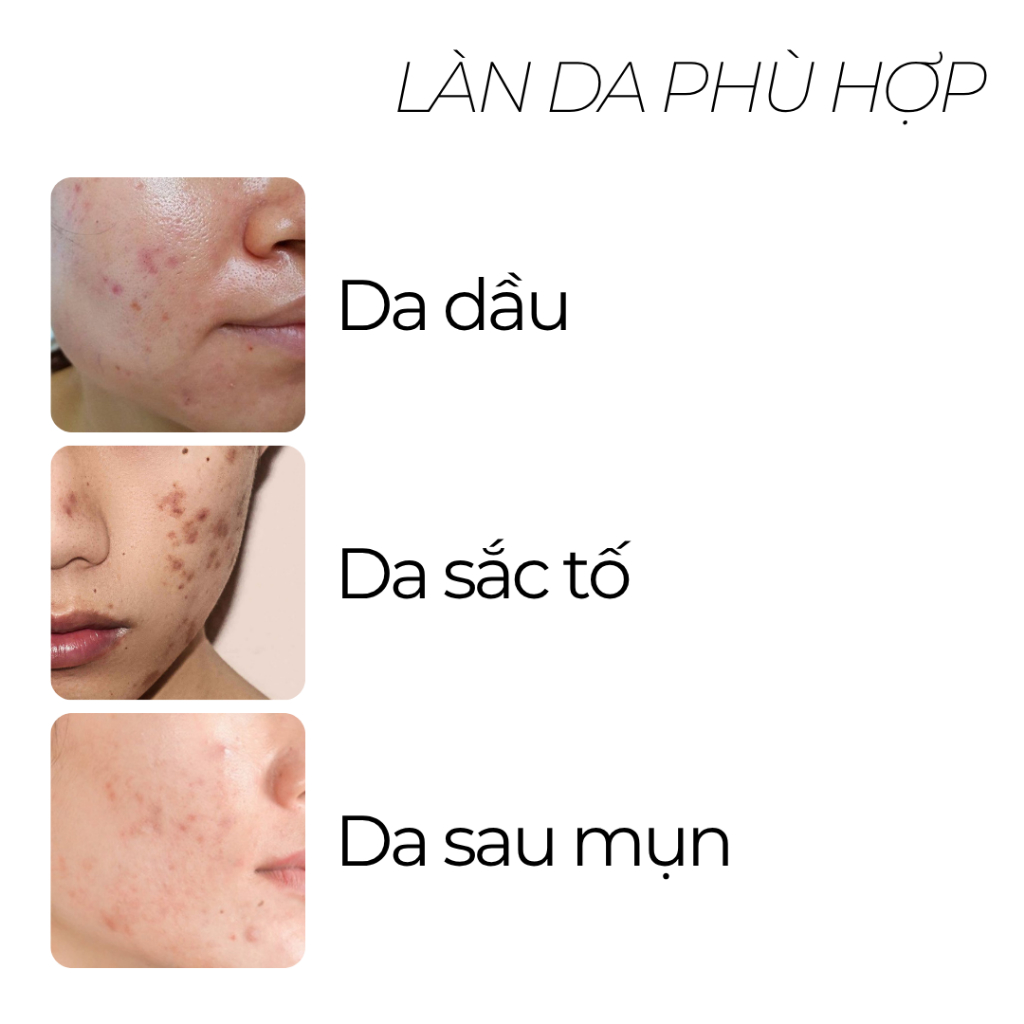 [CB4]COMBO CHĂM SÓC DA 3 BƯỚC: Sữa rửa mặt 100ml + Serum B3 30ml + Gel dưỡng 50ml_thumbnail_4