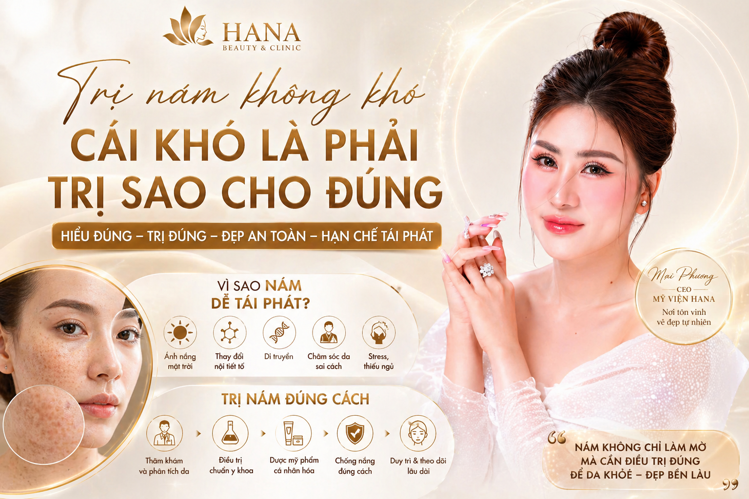 Trị Nám Không Khó, Cái Khó Là Phải Trị Sao Cho Đúng
