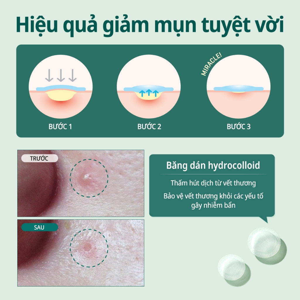 [SOME BY MI] Miếng dán mụn Some By Mi Clear Spot Patch 18 miếng_thumbnail_3