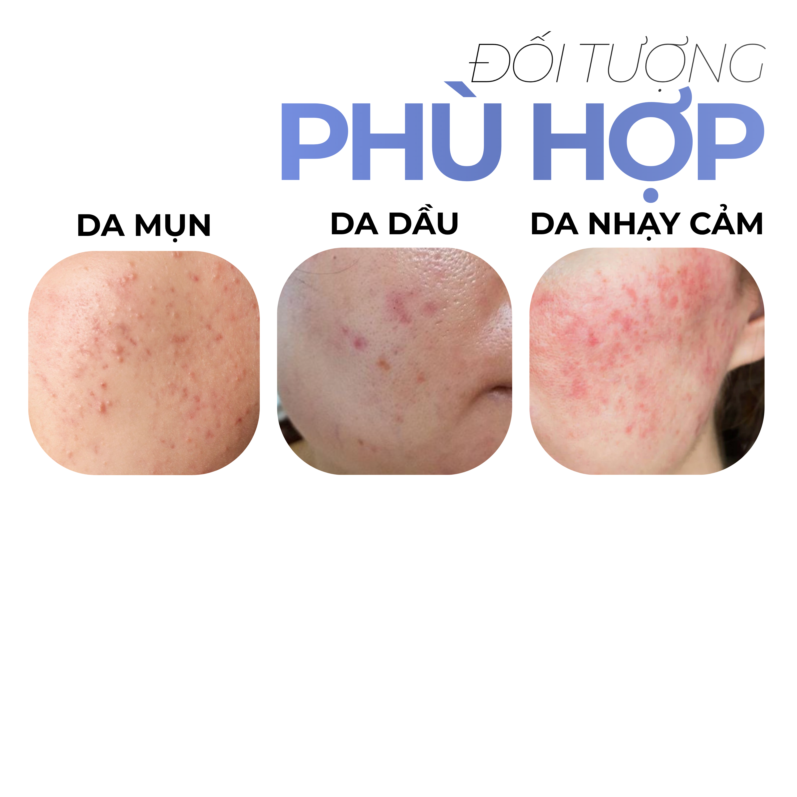 Gel dưỡng ẩm -Saffron Acne-Fighting Brightening Moisturize Gel BONNE MINE_thumbnail_5