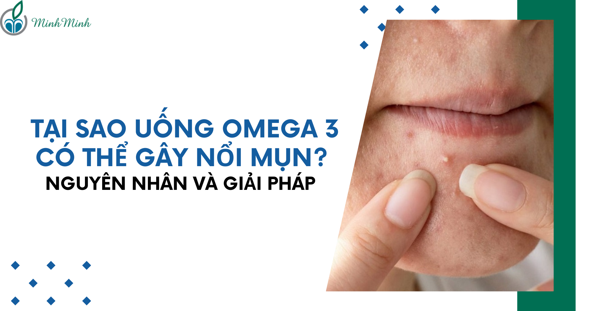 Tại sao uống omega 3 có thể gây nổi mụn? Nguyên nhân và giải pháp