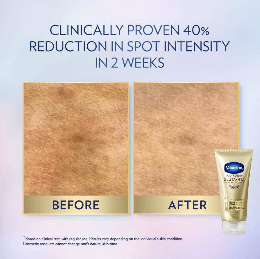 Vaseline® Gluta-Hya Serum Burst Lotion Flawless Bright