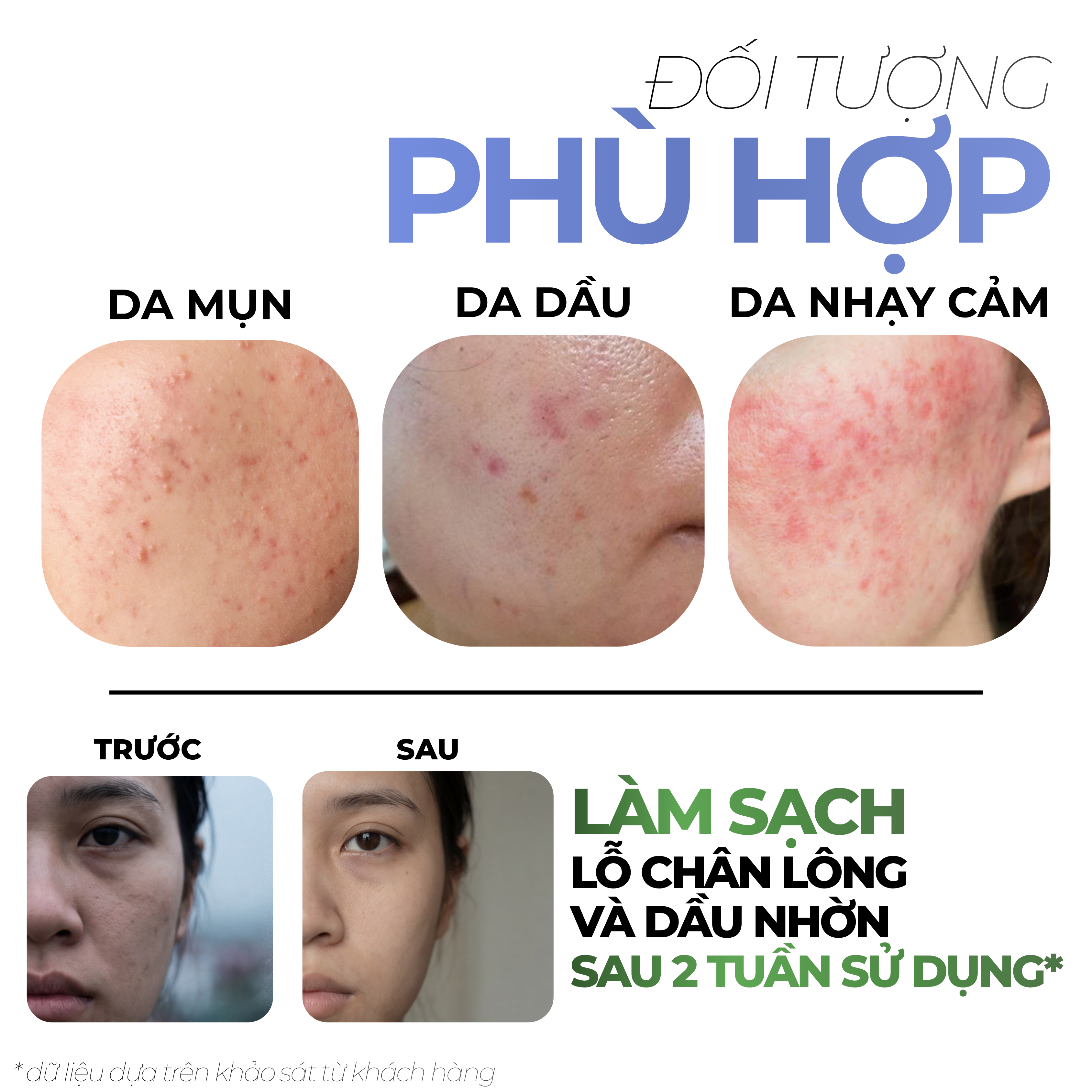 Sữa rửa mặt Soapberry Soothing Cleanser BONNE MINE_thumbnail_6