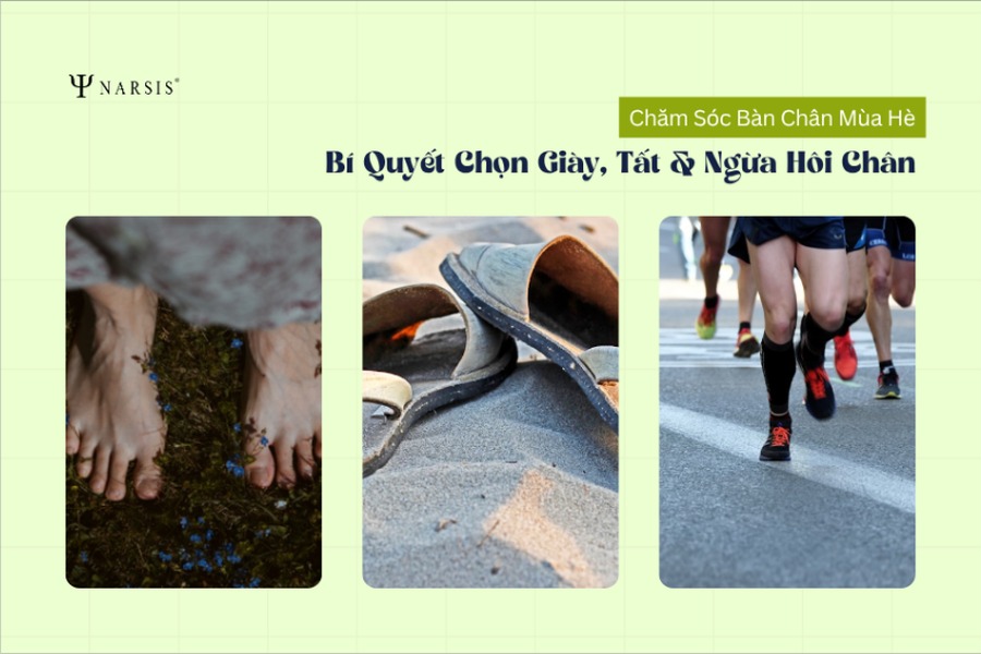 Chăm Sóc Bàn Chân Mùa Hè: Bí Quyết Chọn Giày, Tất Và Phòng Ngừa Hôi Chân, Nấm Da