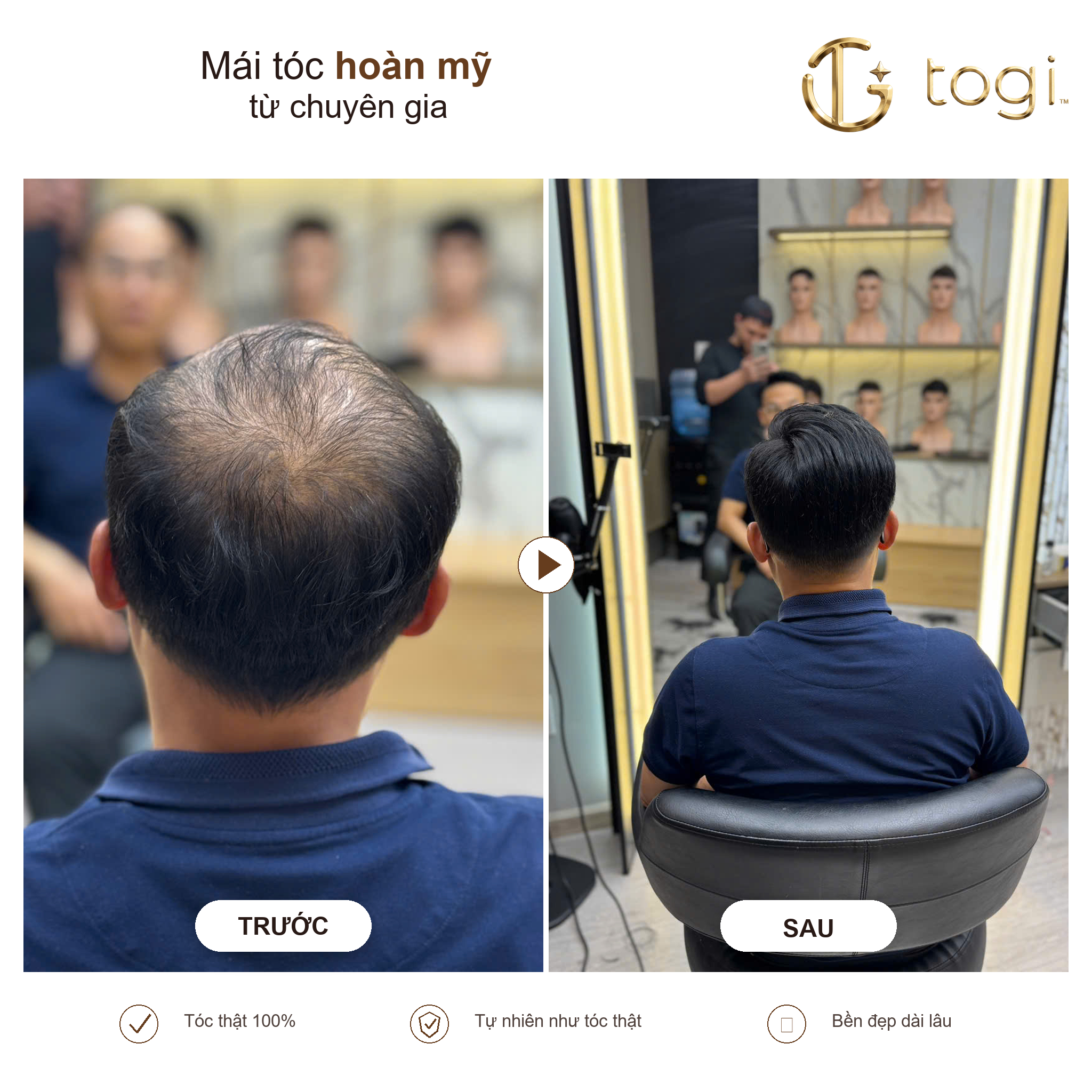 Togi65 sau gáy độ phủ tự nhiên