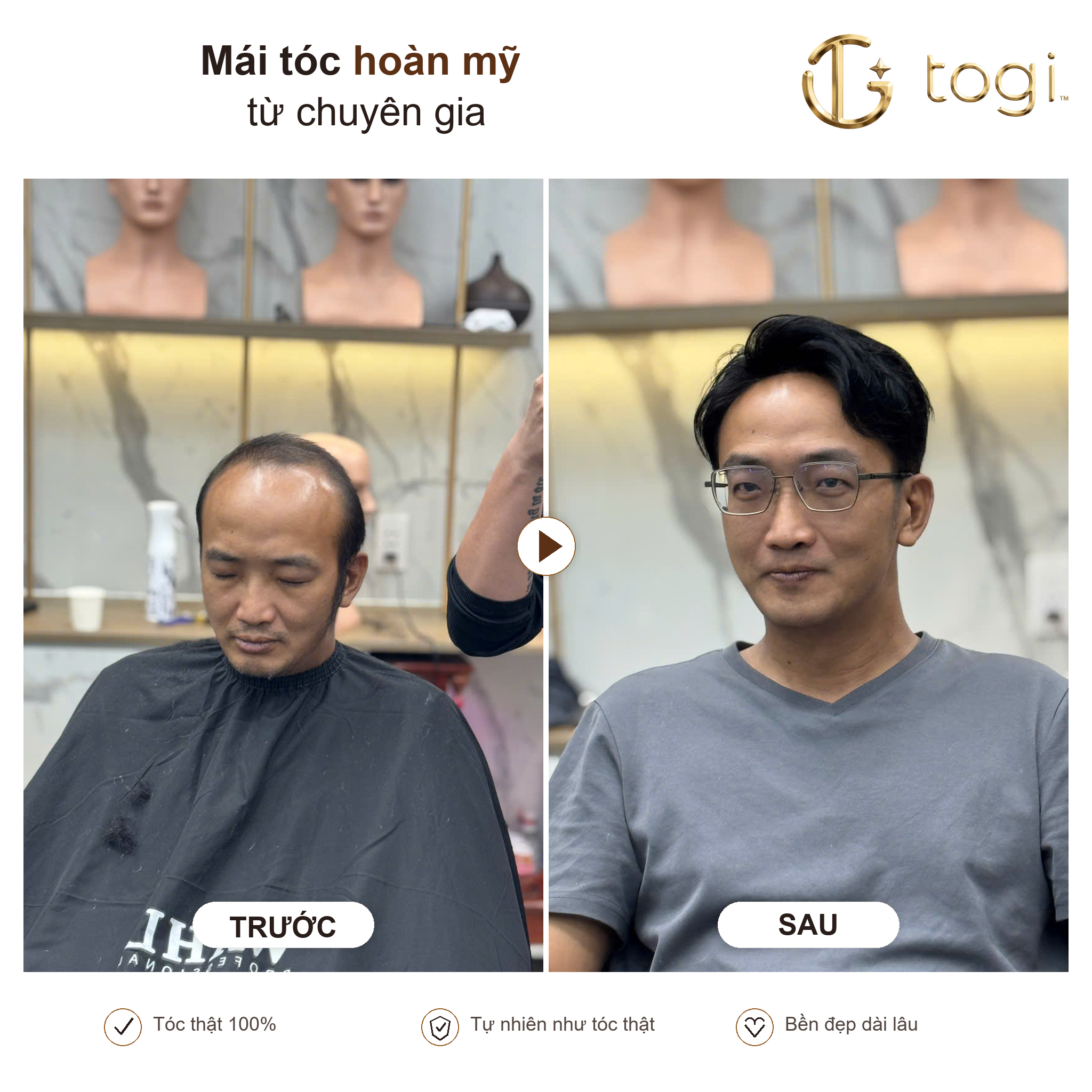 Togi65 chính diện form tóc gọn mặt