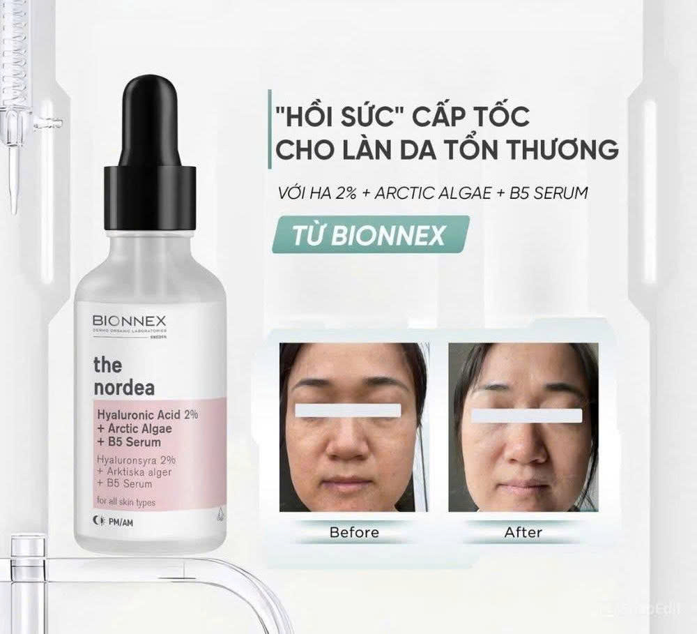 SERUM BIONNEX
