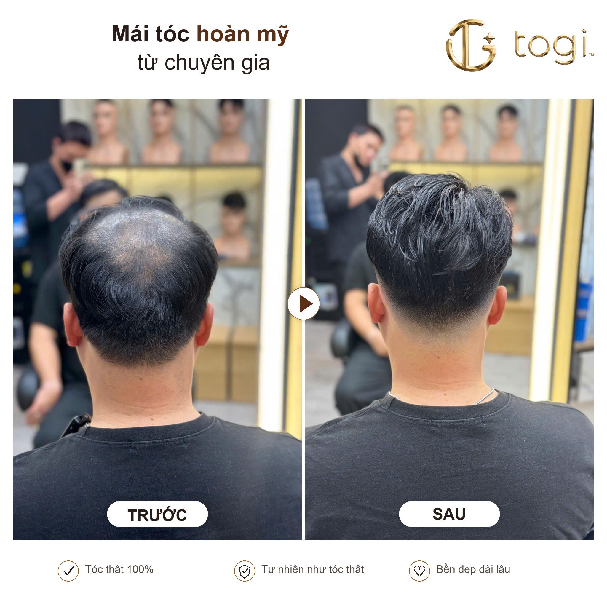 Togi65 sau gáy sau khi hoàn thiện