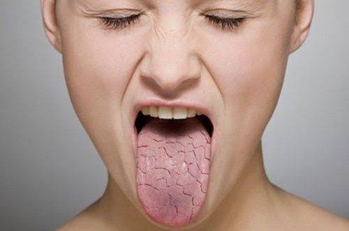 Nguyên Nhân Gây Hôi Miệng: 10 Yếu Tố Thường Gặp Và Cách Cải Thiện
