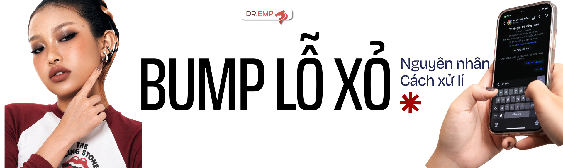 BUMP LỖ XỎ LÀ GÌ? NGUYÊN NHÂN, CÁCH XỬ LÝ VÀ KHI NÀO CẦN ĐIỀU CHỈNH KHÔNG GIAN LỖ XỎ