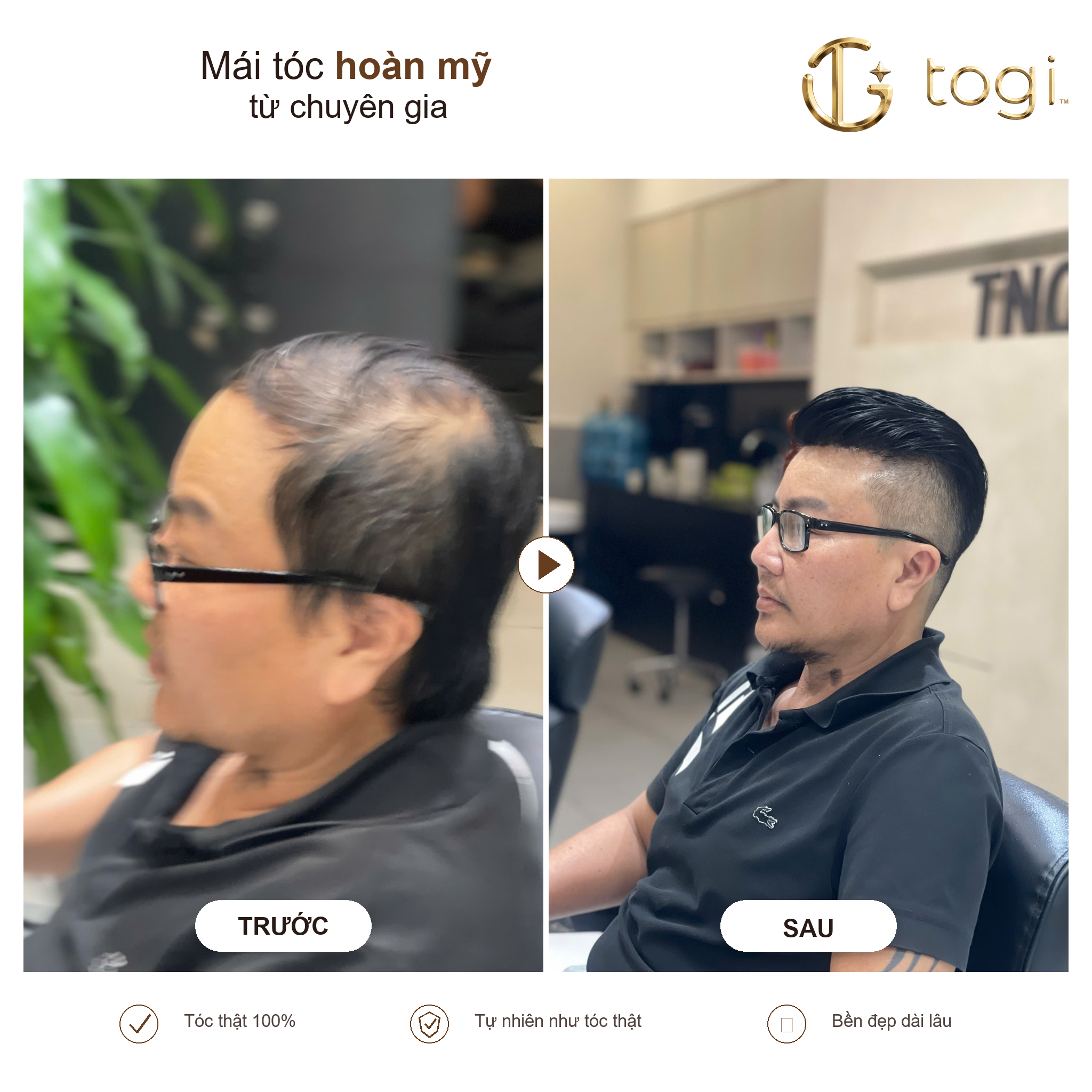 Togi65 góc nghiêng tóc ôm dáng đầu
