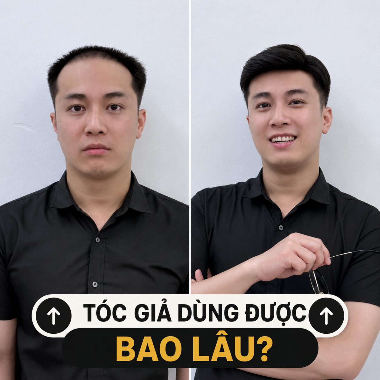 Tóc Giả Nam Dùng Được Bao Lâu? Mua Ở Đâu Uy Tín? | Togihair