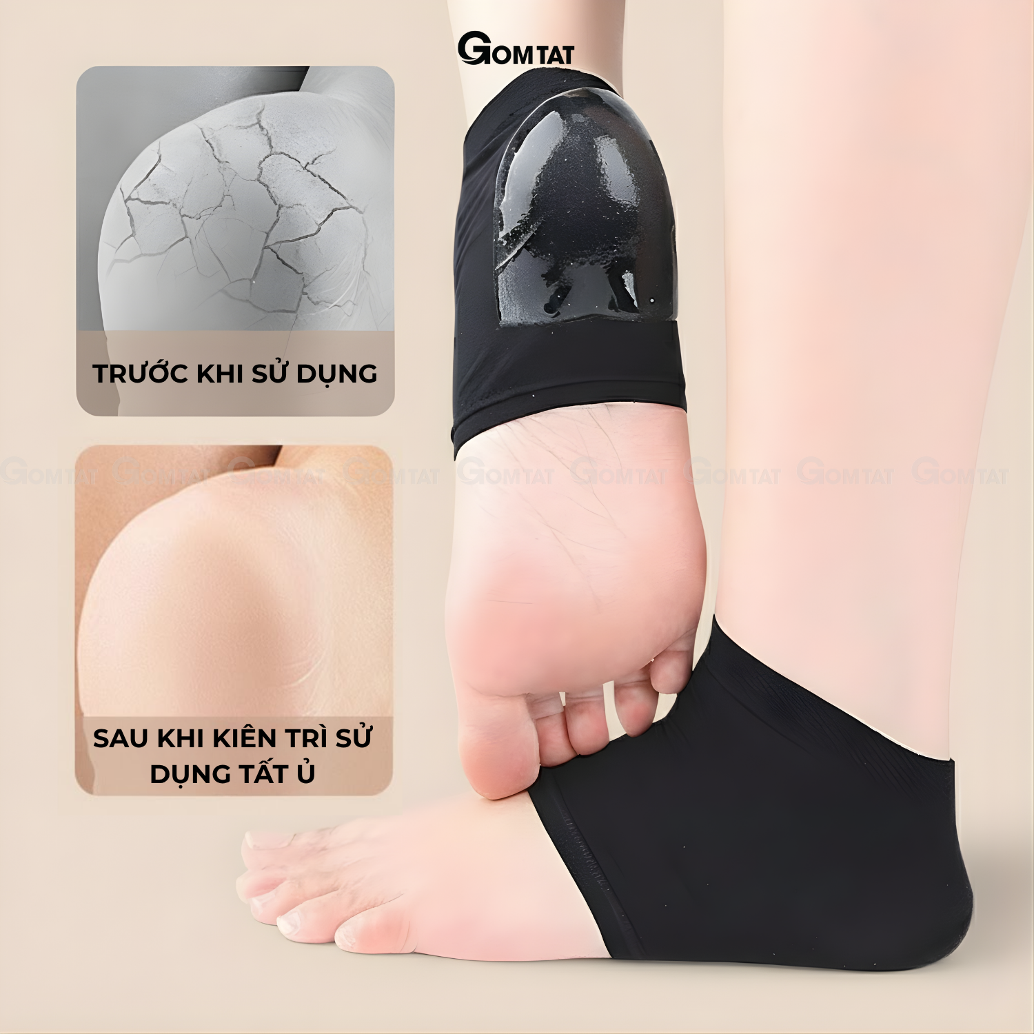 Combo tất ủ gót chân GOMTAT, vớ bảo vệ gót chân có silicon dưỡng ẩm, làm mềm gót - TYU-1027_thumbnail_3