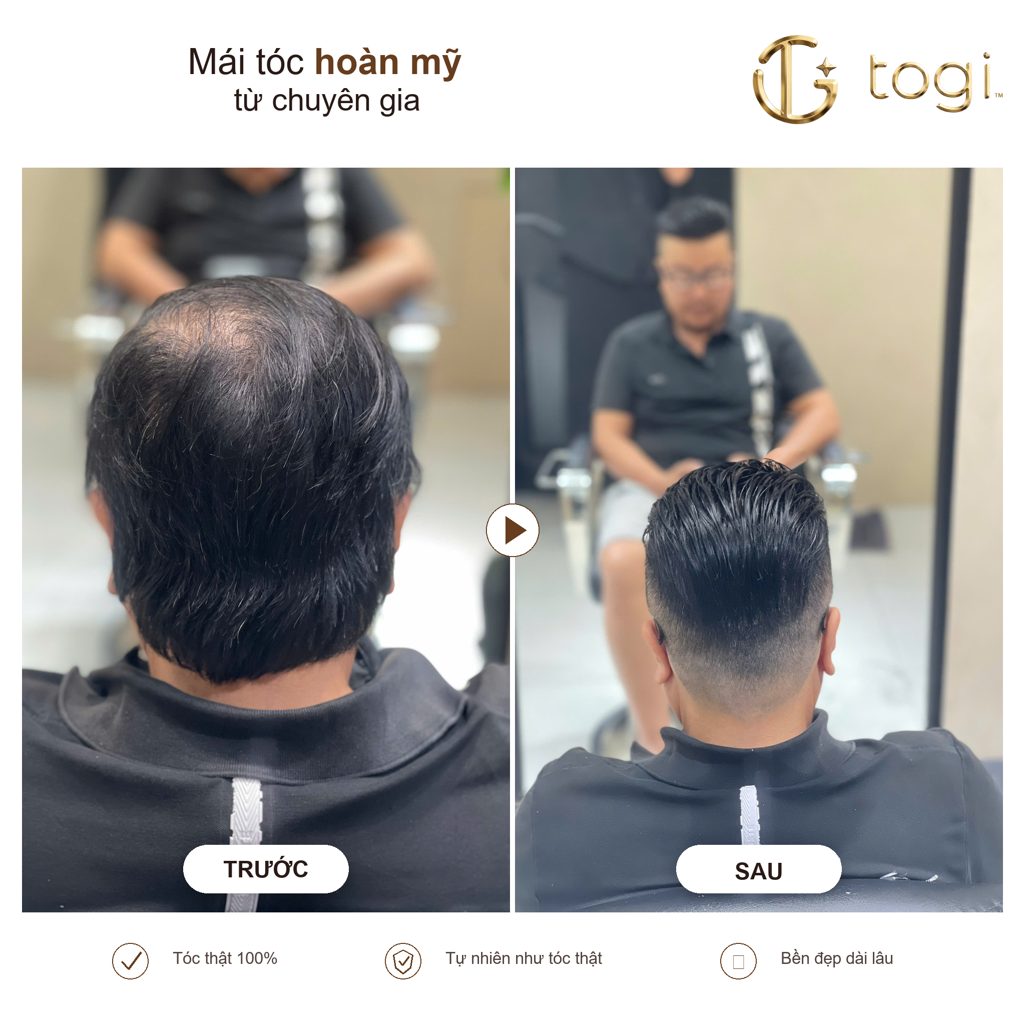 Togi65 sau gáy không lộ khi nhìn phía sau