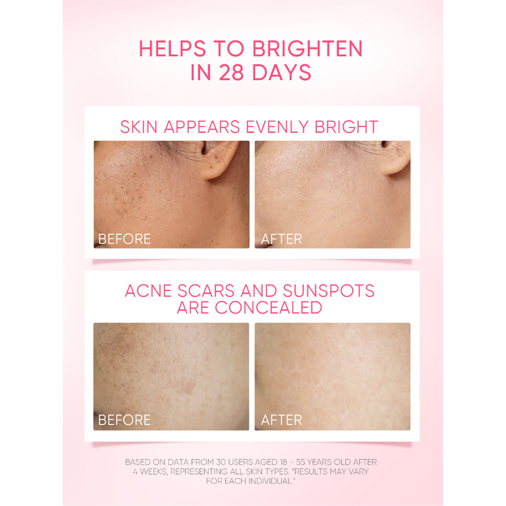 SKINTIFIC TXA Niacinamide Brightening Moisturizer_thumbnail_5
