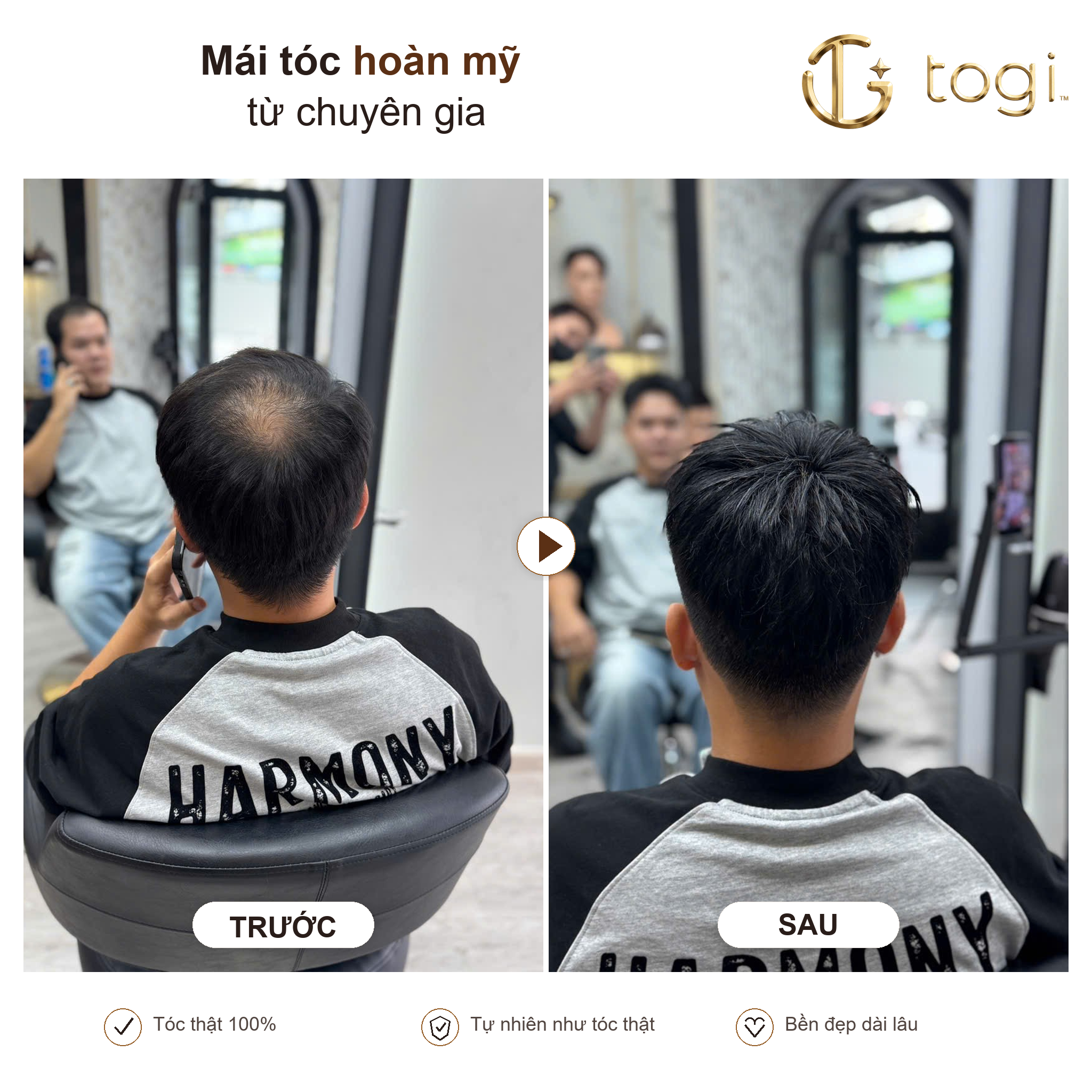 Togi65 sau gáy nhìn từ phía sau