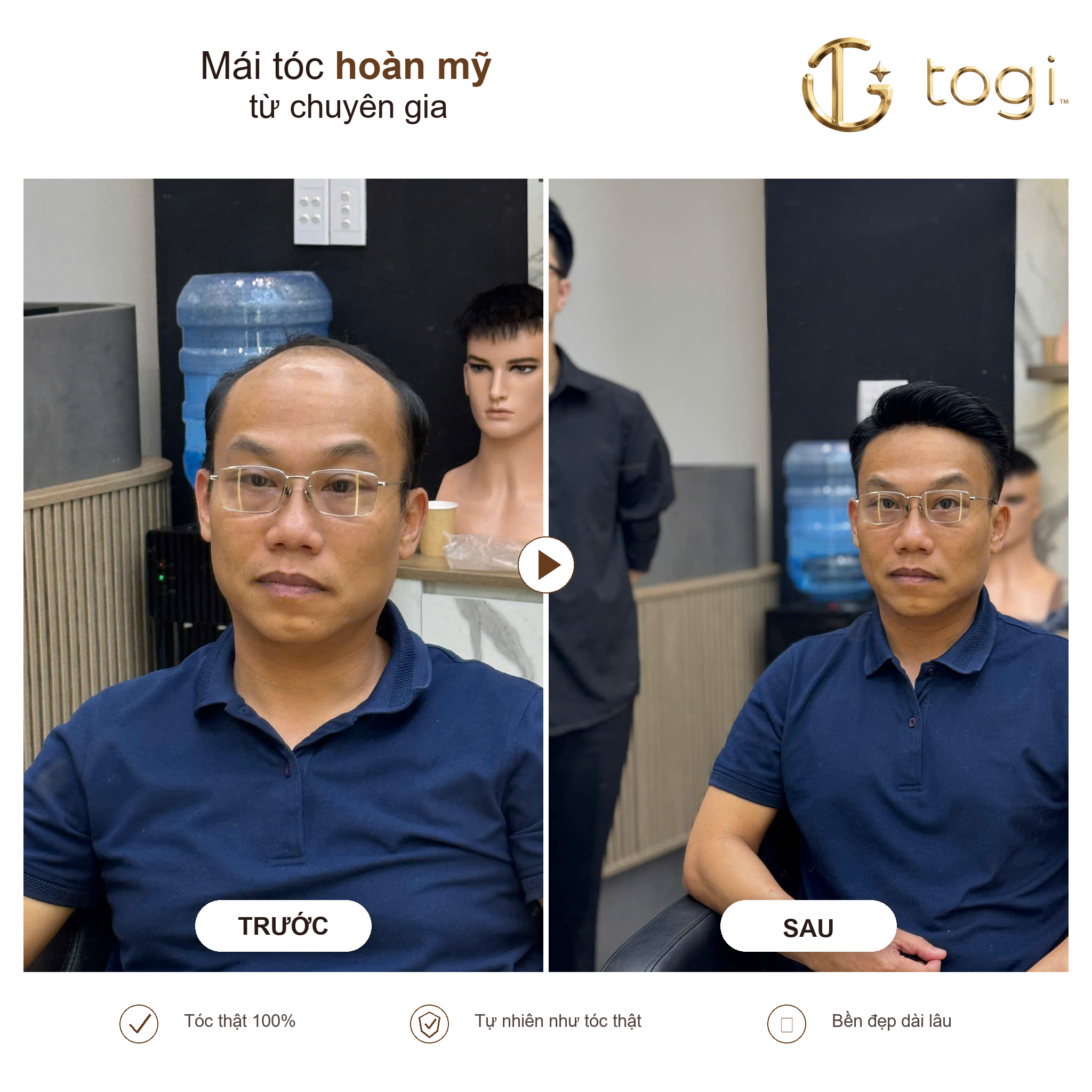 Togi65 chính diện kiểm tra đường trán tự nhiên