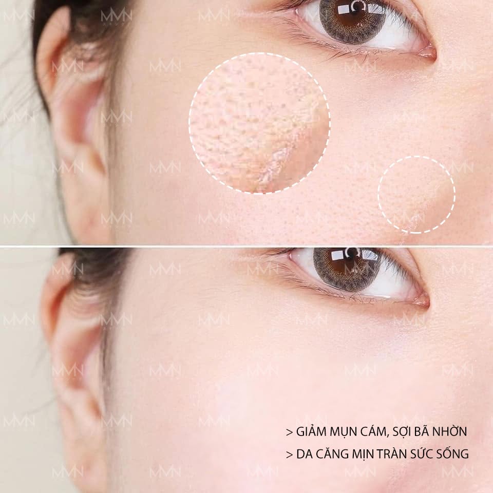 Nước thần Toner MMN Damacus Rose Face Toner 150ml_thumbnail_4