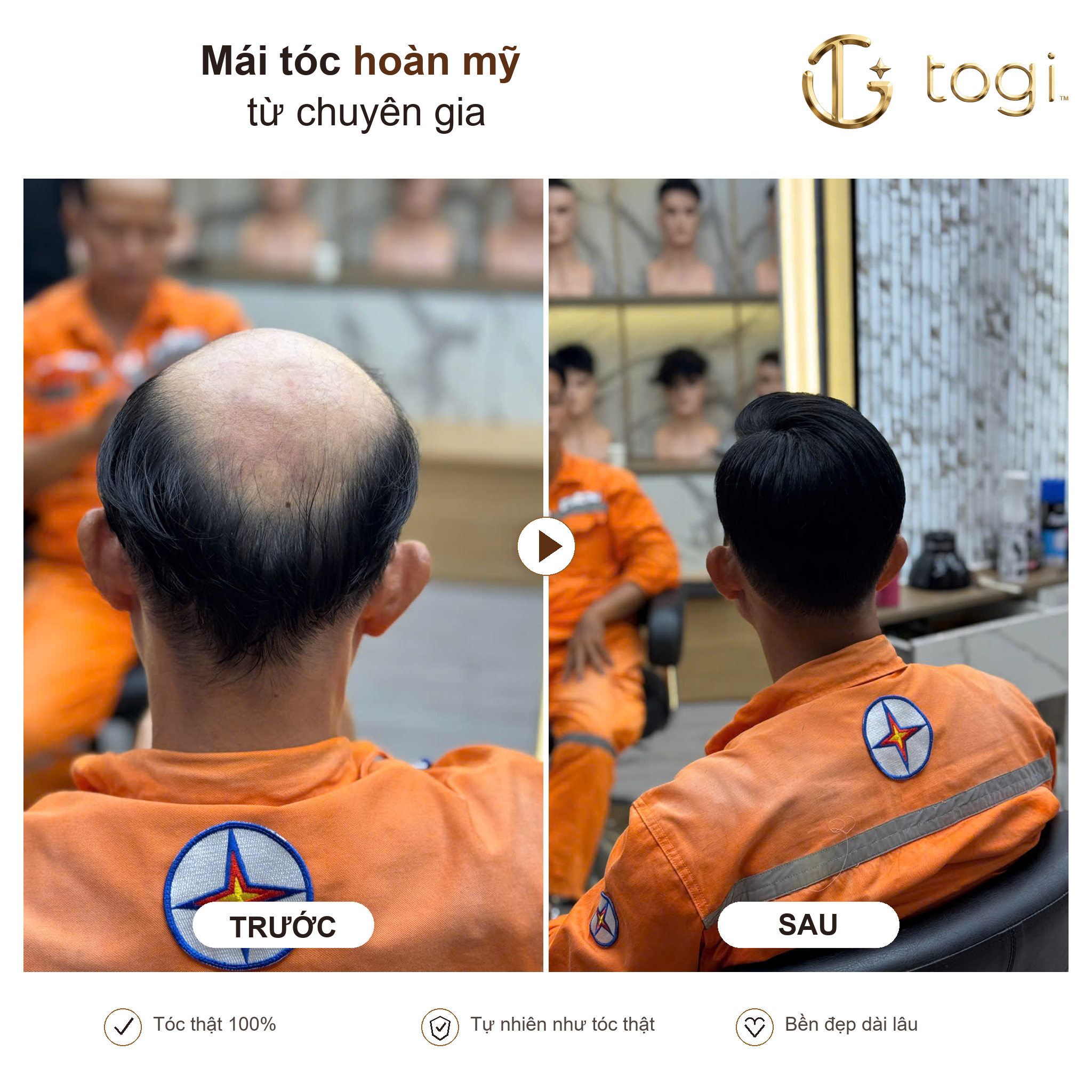 Togi65 sau gáy mật độ tóc tự nhiên