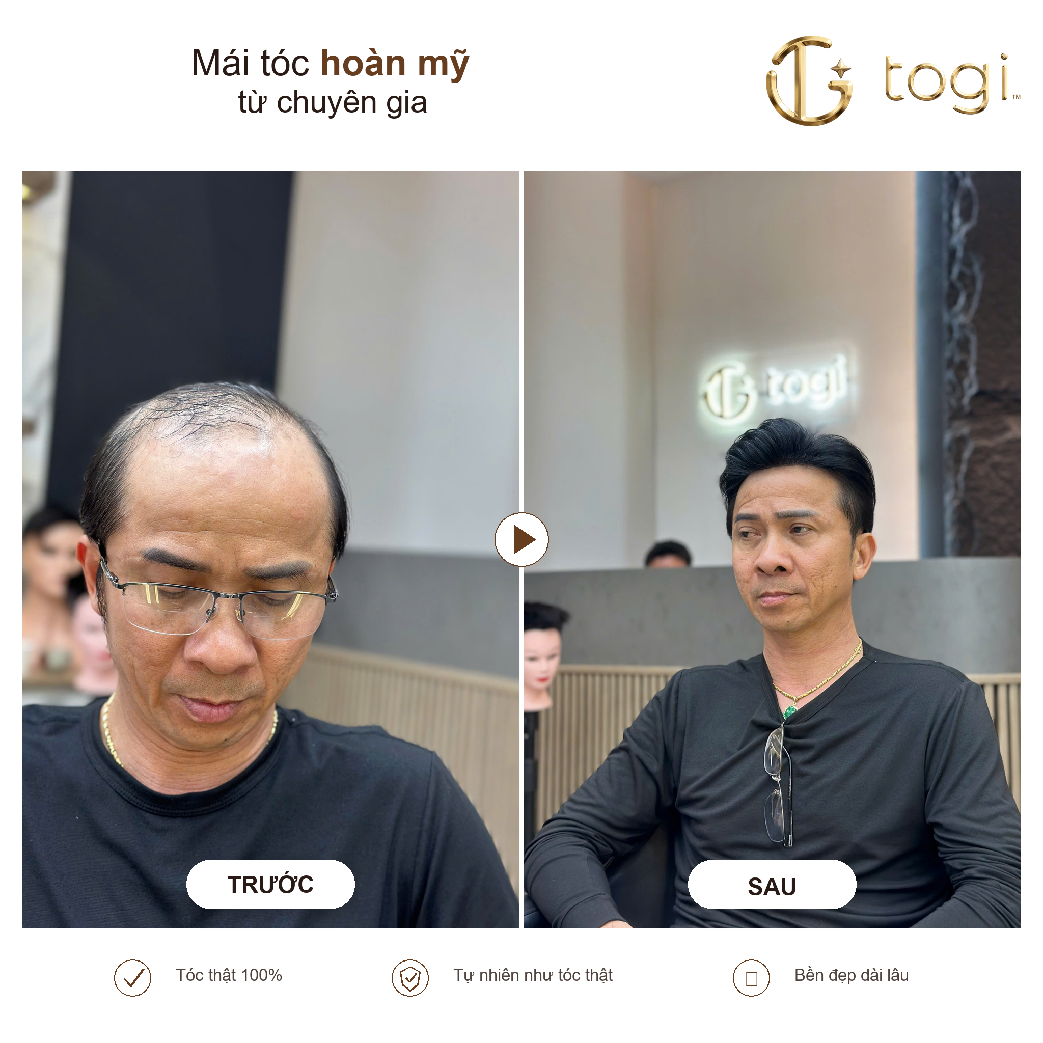 Togi65 chính diện tóc dày gọn tự nhiên