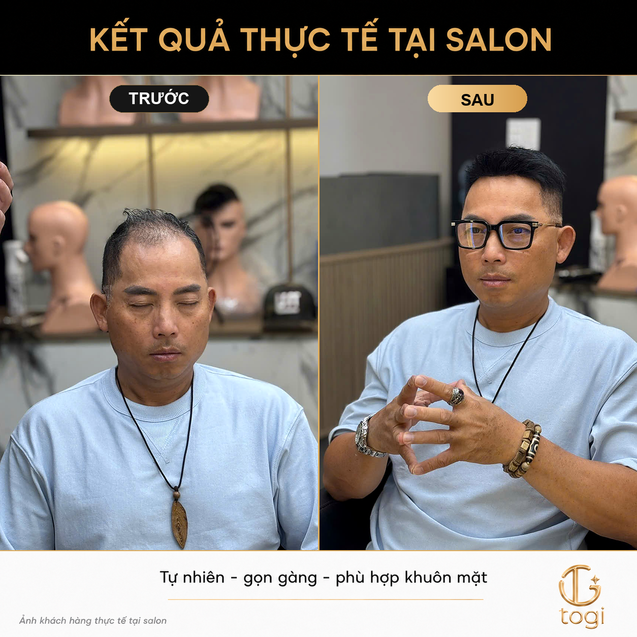 Việt Kiều Về Việt Nam Làm Tóc Giả Nam: Tư Vấn Và Đặt Lịch Trước